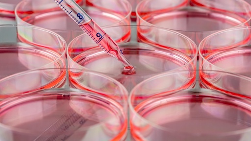 [SK-STEM-174] Human Induced Pluripotent Stem Cells (iPS)